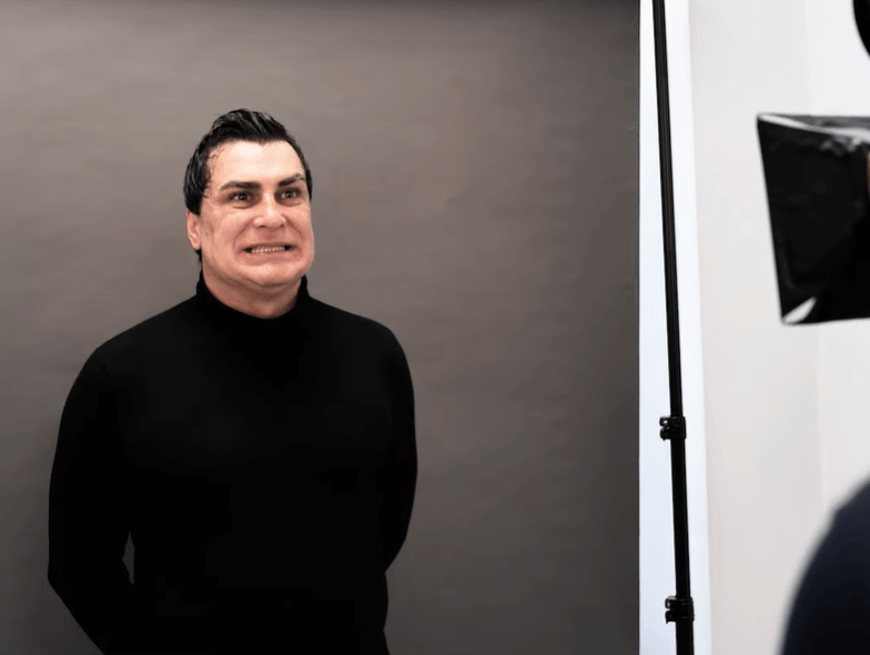 Florin - Dantură Fixă pe 6 Implanturi (All-on-6)