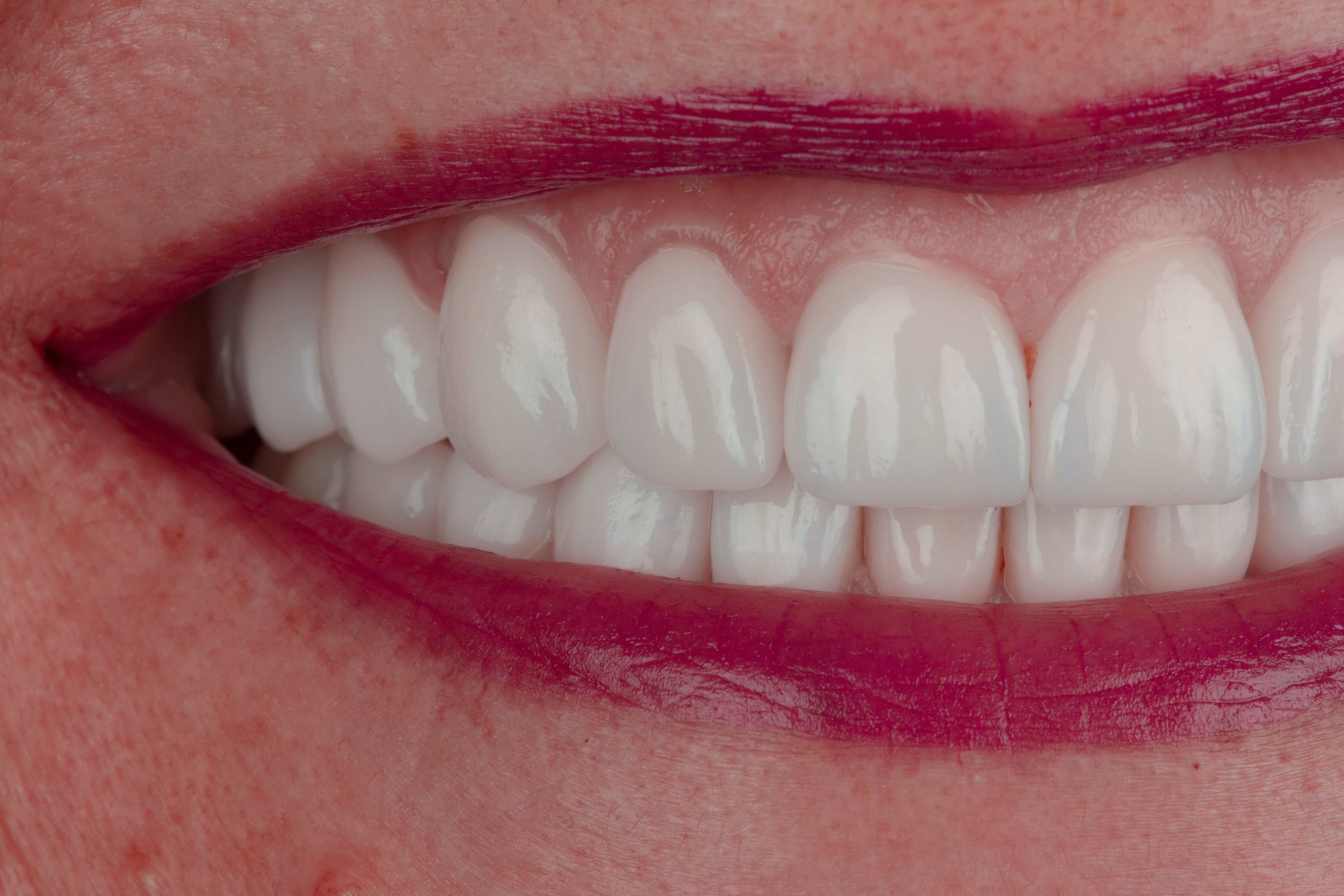 Implantologie dentară