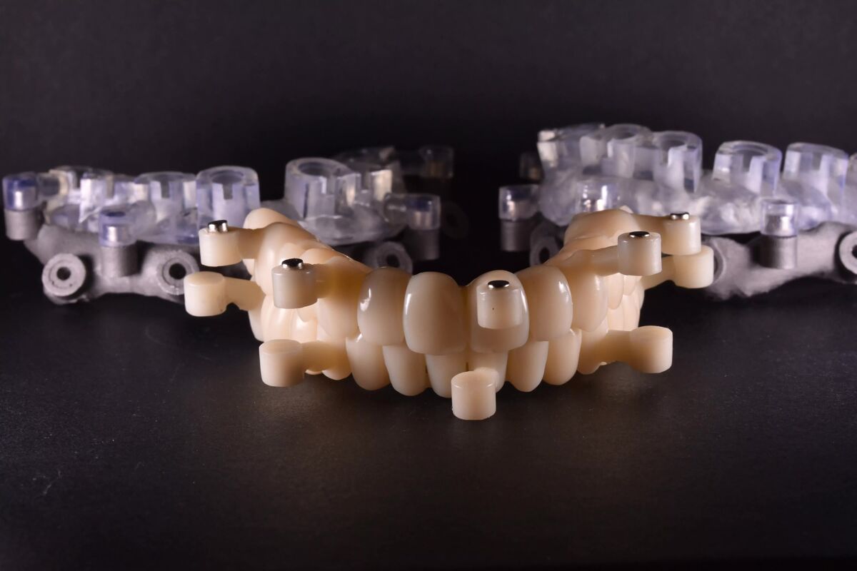 reabilitări-protetice-pe-implanturi-dentare