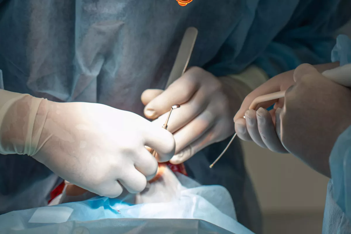 Afectiunea parodontala 2